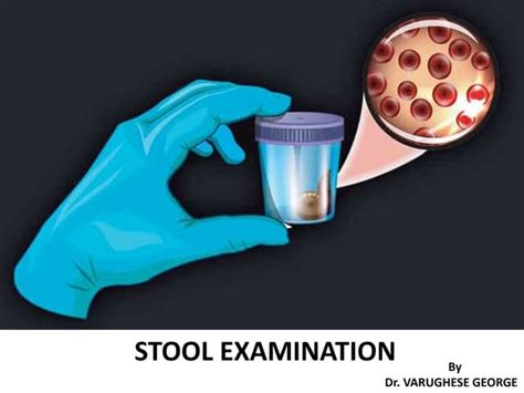 why stool test is done